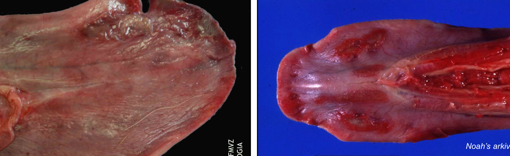 <p>High BUN → thrombosis → ischemia → infarction → <strong><u>ulceration</u></strong></p><p></p>