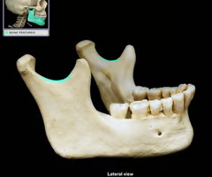 indentation at the edge of a structure