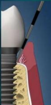 <p>What are you measuring here?</p>