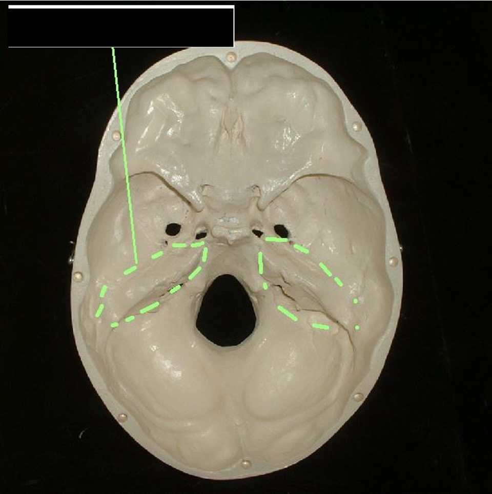 <p>Diagonal rigid bone inside the top of the skull. (Think Cayman Islands Hell)</p>