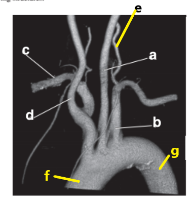 <p>Which letter is the left subclavian artery ?</p>