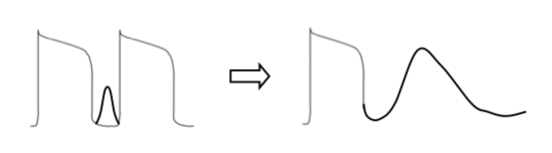 <p>calcium current </p><ul><li><p>we usually don’t see it as its only for contractions</p><ul><li><p>as it does not affect depolarization or repolarization</p></li></ul></li><li><p>it’s drawn in to demonstrate the early calcium current ==&gt; DAD</p></li></ul><p></p>