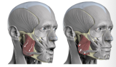 <p>What muscle is this?</p>