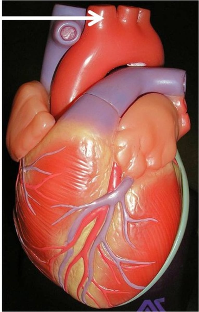 <p>Function: carries oxygenated blood to the neck, head, and right anterior limb</p>