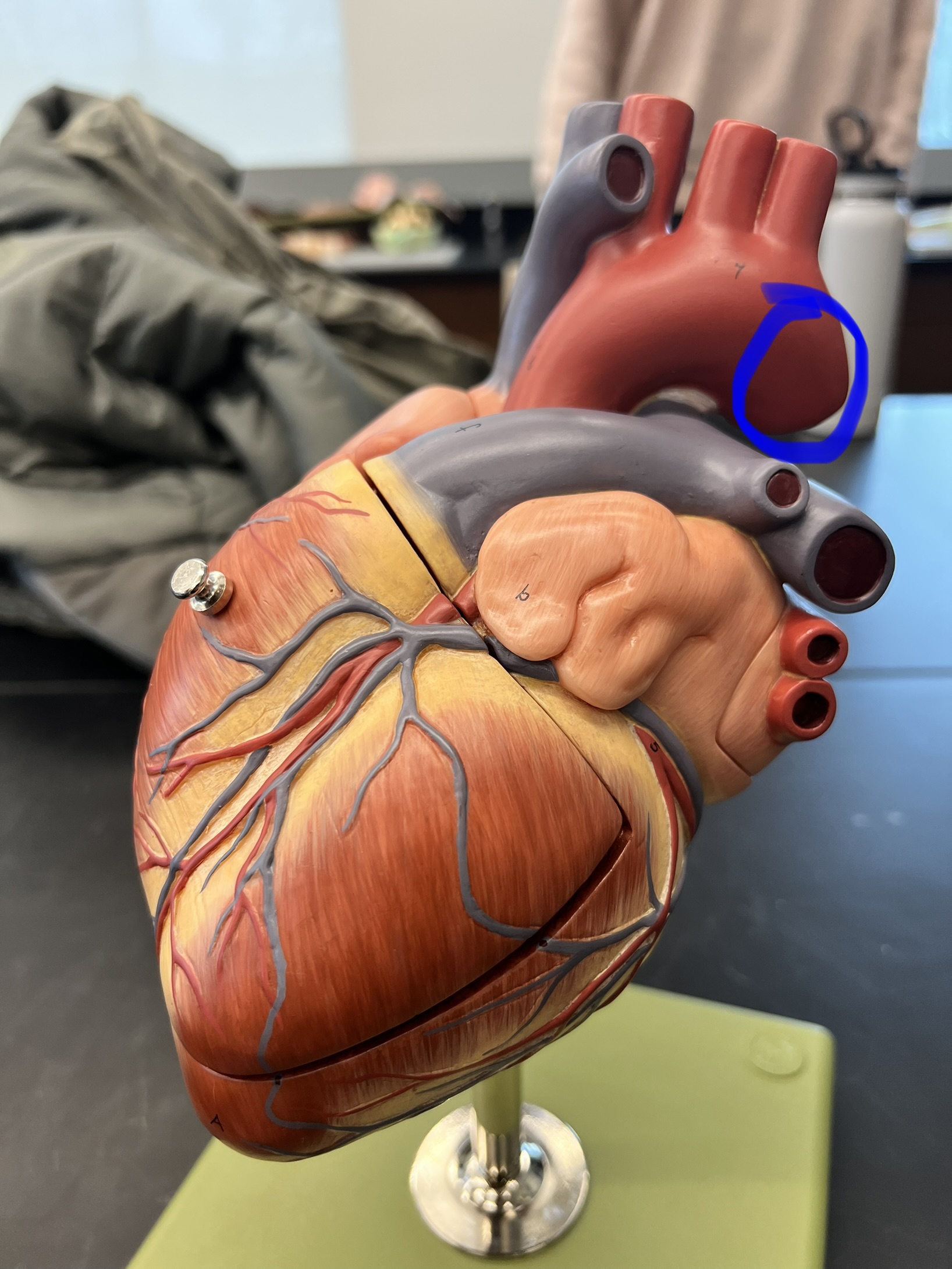 Name the heart structure.