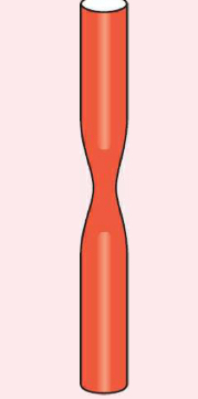 <p>• narrowing of the arterials</p><p>• occurs with hypertension </p>