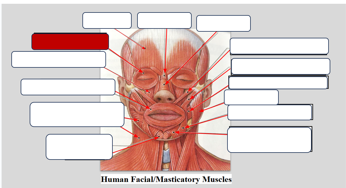 <p>Label the muscle.</p>