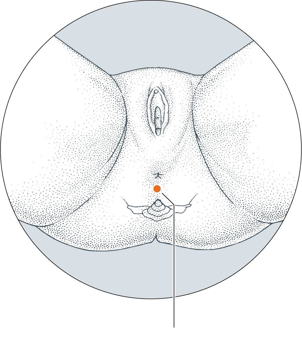 <p>DU-1</p>