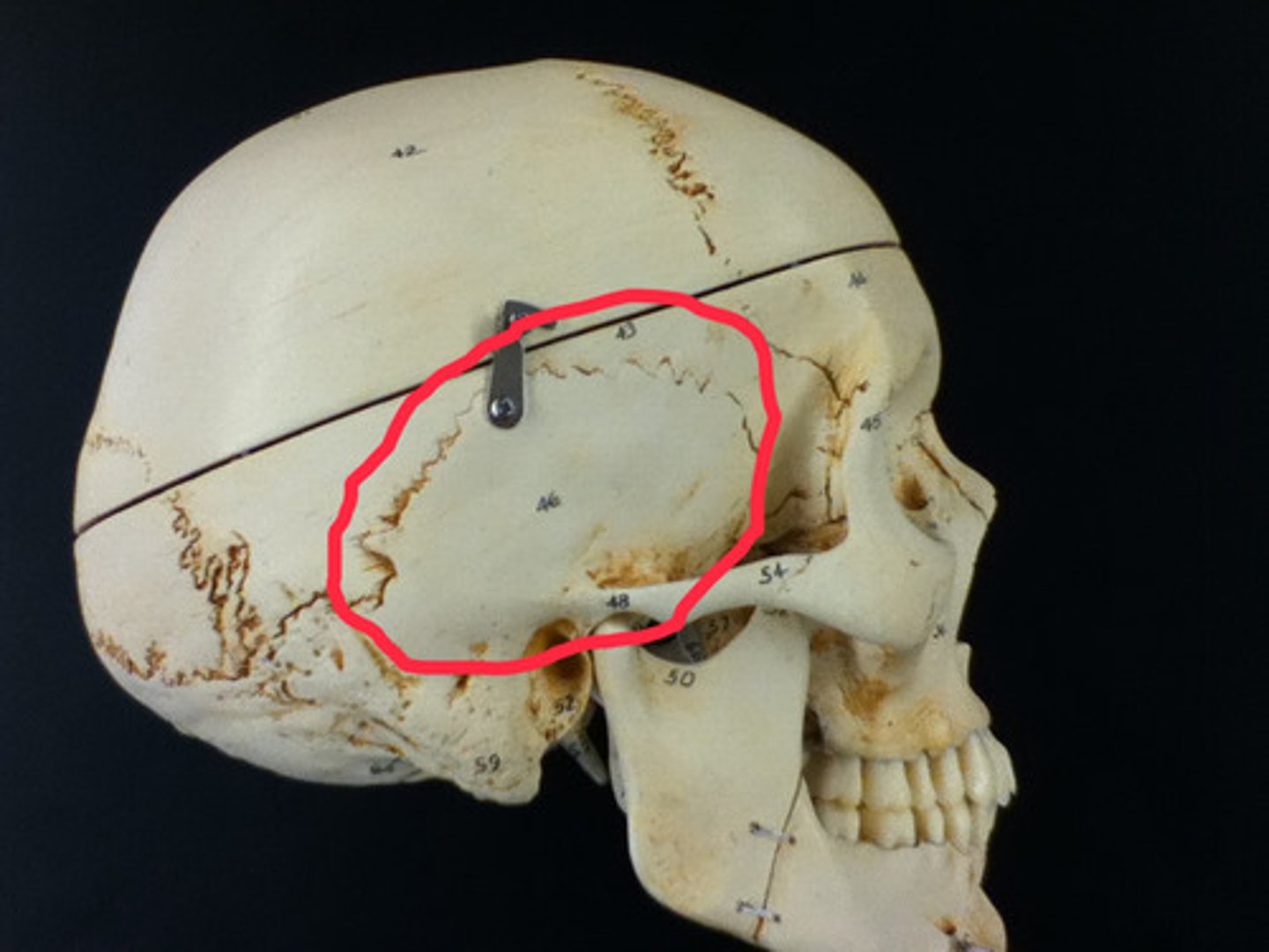 <p>part of temporal bone</p>