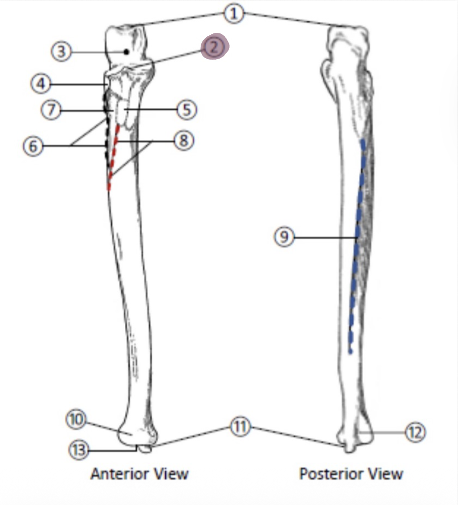 <p>On the Proximal end of the Ulna, which part is highlighted (2)?</p>