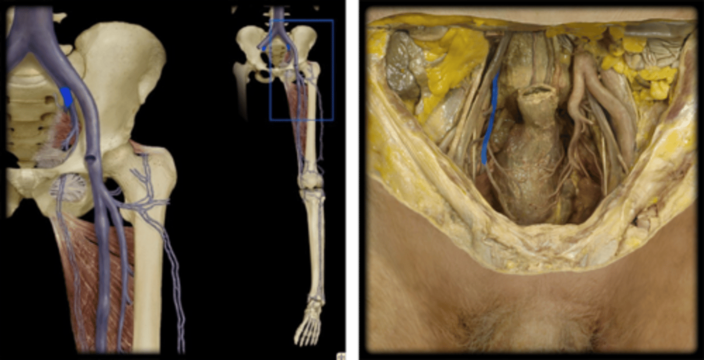 <p>Name these vessels.</p>
