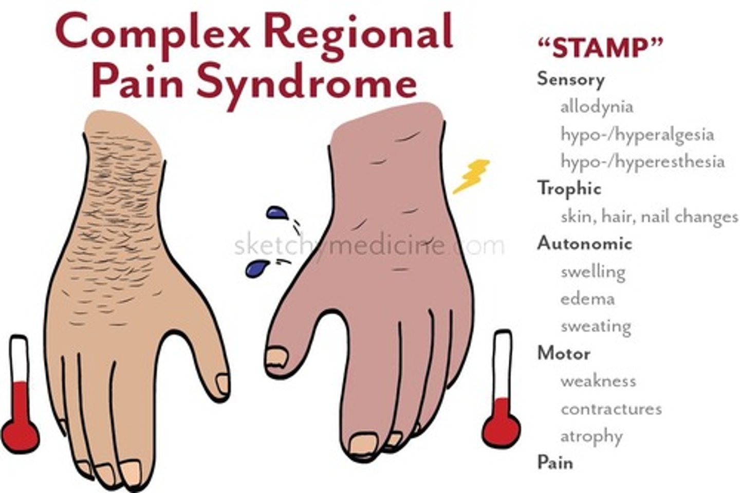 <p>A condition characterized by excess and prolonged pain and inflammation following an injury.</p>