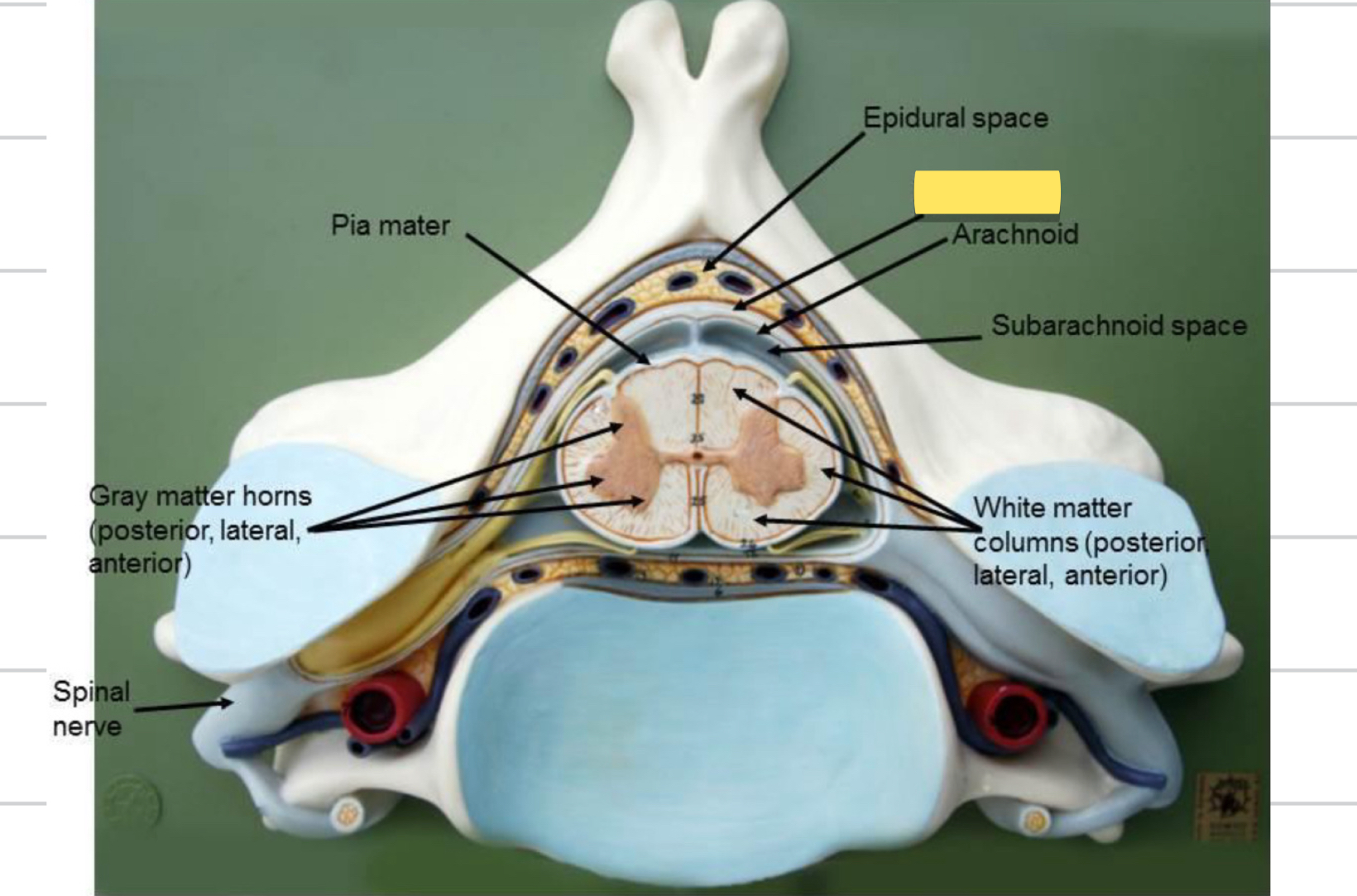 <p>Name this spinal cord part</p>