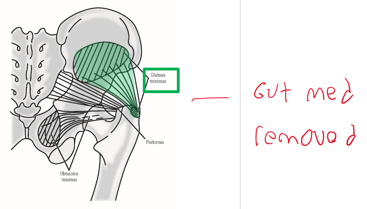 <p><u><span>Origin</span></u><span>: lateral (external) surface of ilium portion of hipbone (deep to m. gluteus medius)</span></p><p><u><span>Insertion</span></u><span>: greater trochanter of femur</span></p><p><u><span>Action</span></u><span>: abduction of thigh at hip joint</span></p><ul><li><p><span>Action during walking: with one foot off the ground, these muscles contract on </span><u><span>weight-bearing side</span></u><span> to maintain horizontal position of the pelvis</span></p></li></ul><p><span>—» Prevents drop of unsupported side of pelvis by pulling pelvis toward weight-bearing limb</span></p>