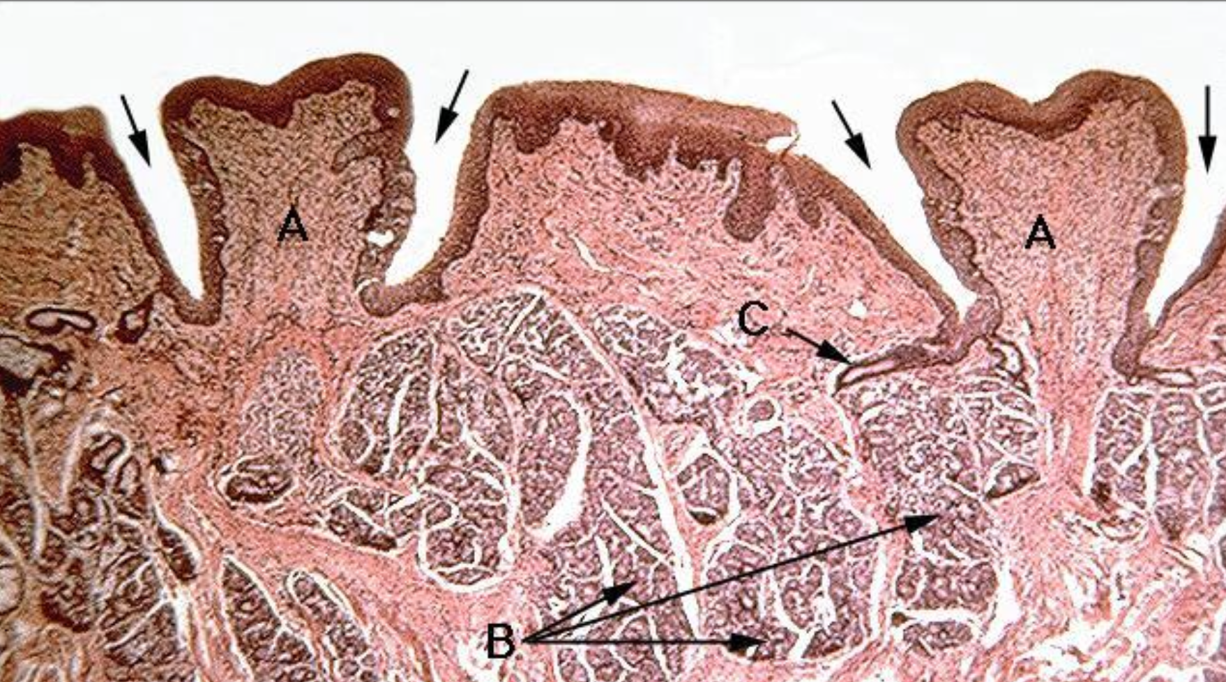 <p>ID A</p>