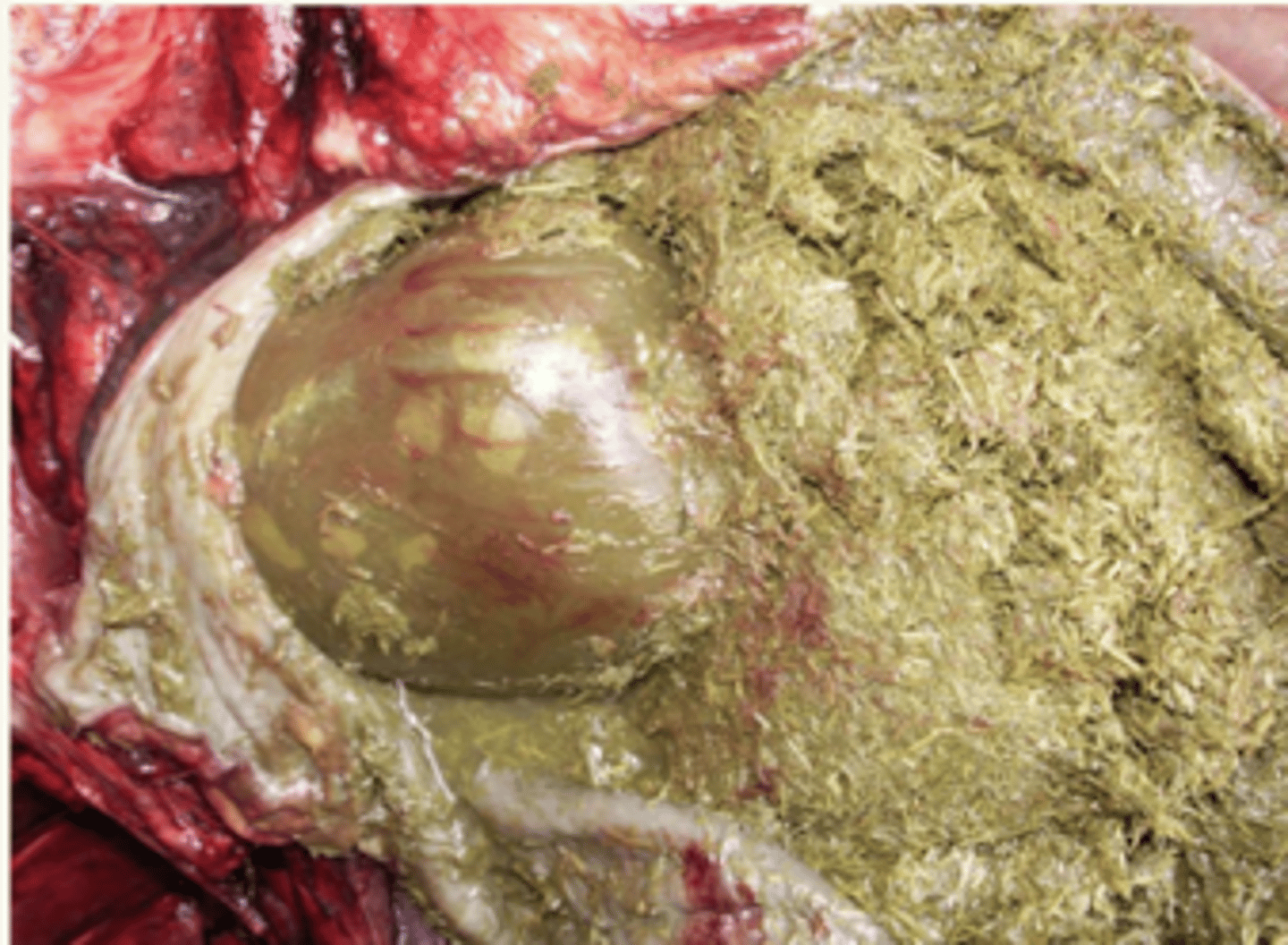 <p>¿patología?</p>