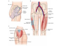 90 degree angle
ex. corticosteroid like dexamethasone