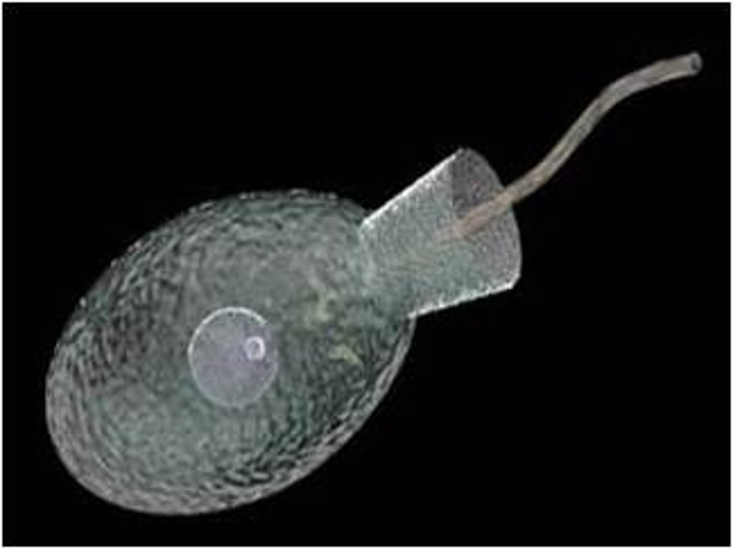 <p>feeding cells with long flagellum</p>