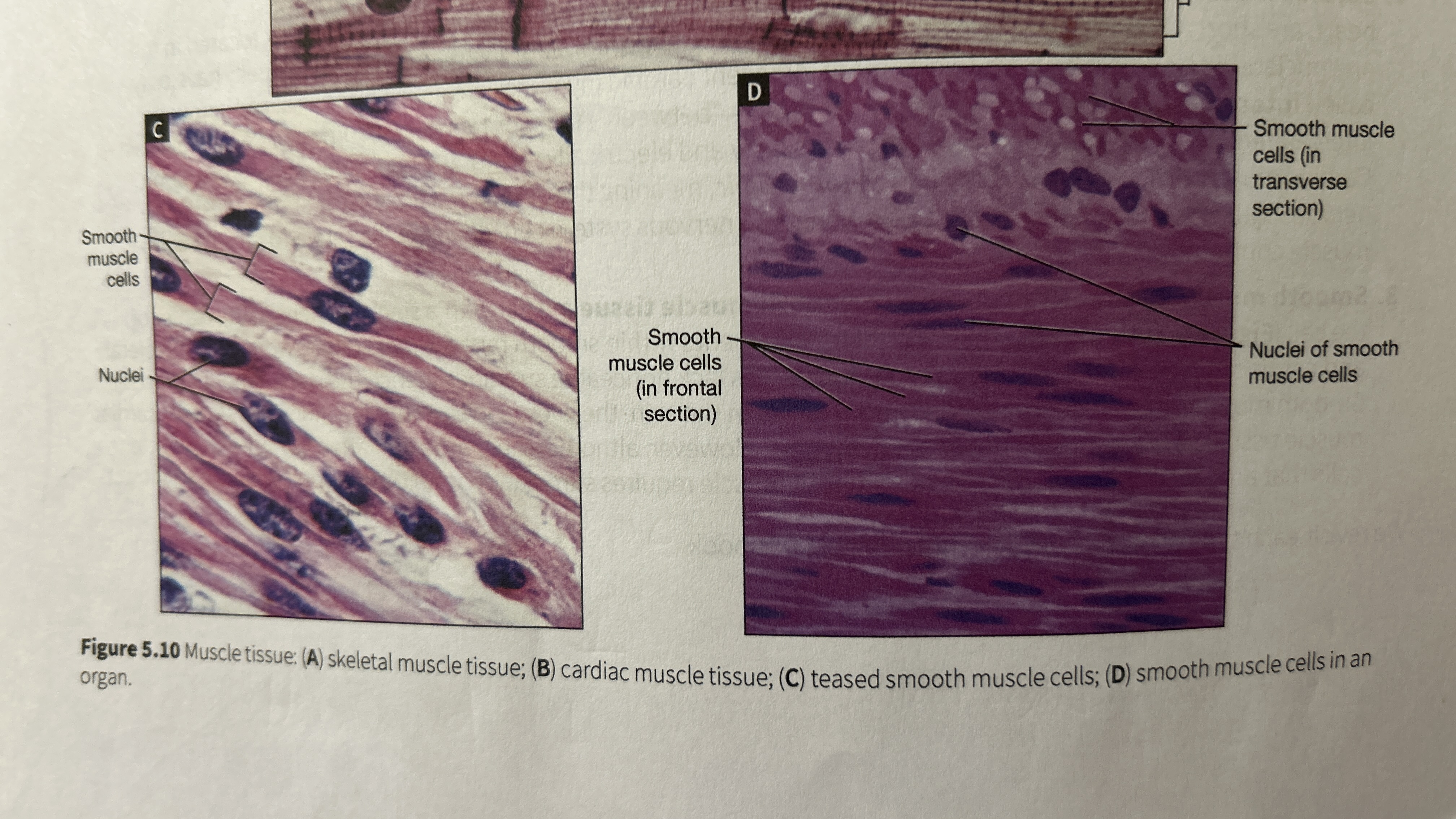 <p>Smooth Muscle Tissue </p>