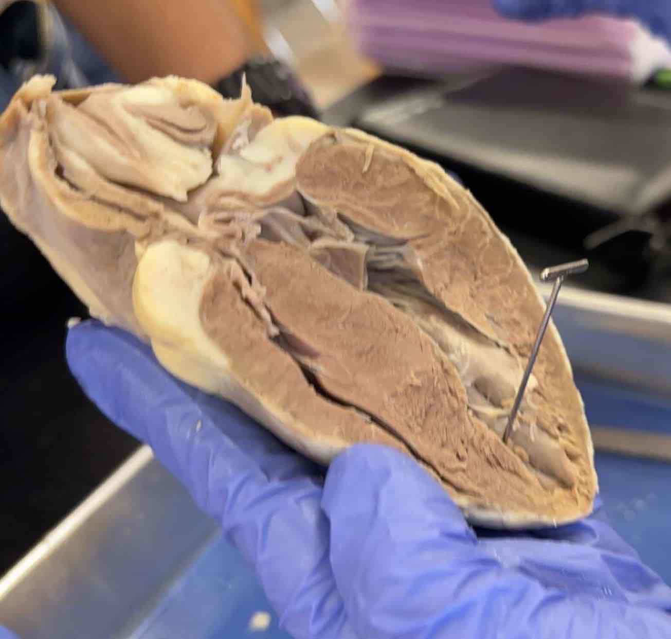 <p>What cavity of the heart is this?</p>