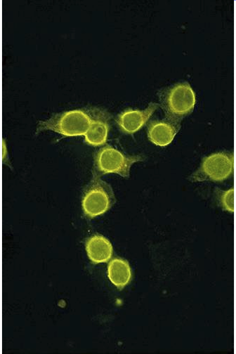 <p>What does this stain show</p>