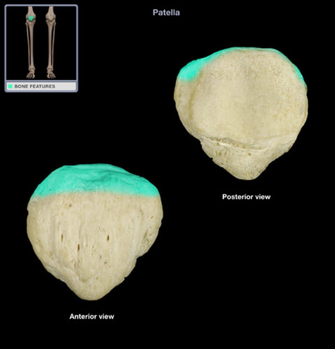 <p>superior surface for quadriceps tendon</p>