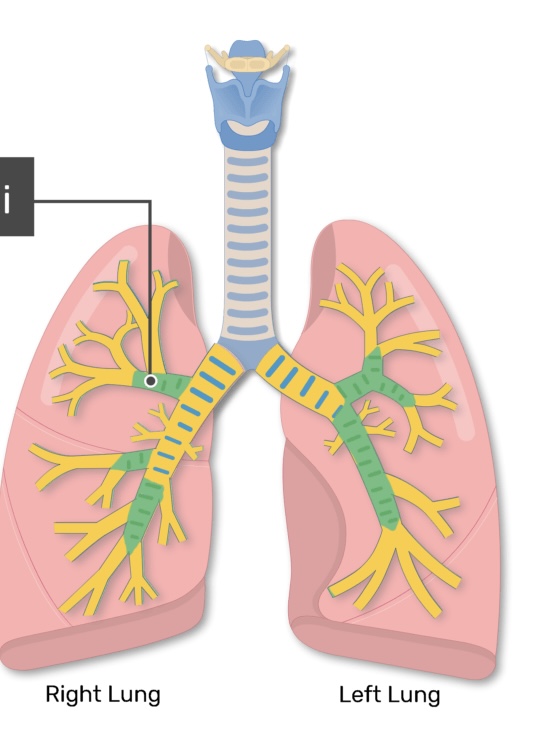 <p>The section of the bronchial tree that branches from the primary bronchi is known as <strong><em></strong></em>__.</p>