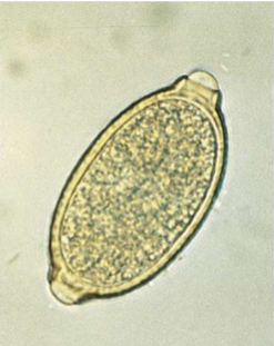 <p>where is&nbsp;<span>Eucoleus aerophilus located in host&nbsp;</span></p>