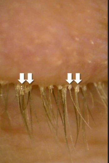 term image