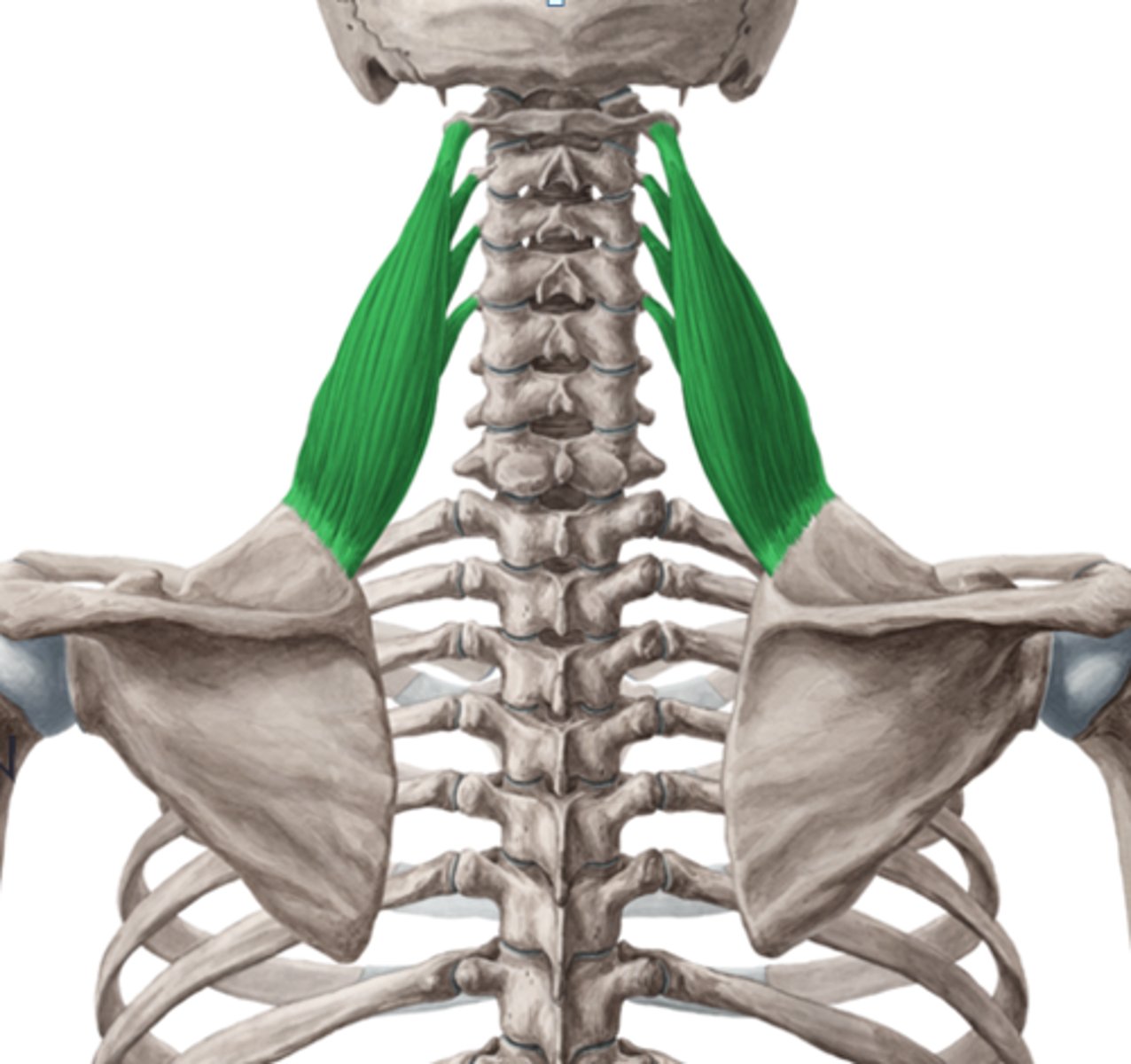 <p>superior angle of the scapula</p>