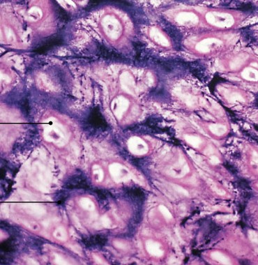 <p>Which type of cartilage has:</p><ul><li><p>Elastic fibers within a matrix</p></li><li><p>Flexible support, supportive but bends easily</p><ul><li><p>found in external ear and epiglottis</p></li></ul></li></ul><p></p>