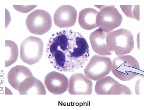 <p><strong>Most numerous</strong> <strong>leukocyte </strong>in blood,&nbsp;<strong>50-70%</strong> of all white blood cells</p><ul><li><p><strong>Multilobed </strong>nucleus</p></li><li><p>Cytoplasm has<strong> pale granules</strong> when stained</p></li></ul><ul><li><p>Enter tissue spaces and<strong> phagocytize infectious pathogens</strong></p></li><li><p><strong>Numbers rise</strong> dramatically in chronic <strong>bacterial infection</strong></p></li></ul><p></p>