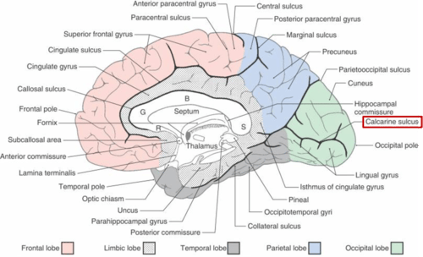 <p>calcarine fissure/sulcus</p>