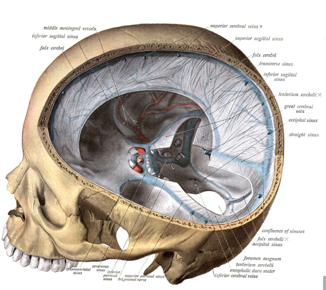 <p>The falx cerebri (along the midline of the brain)</p>