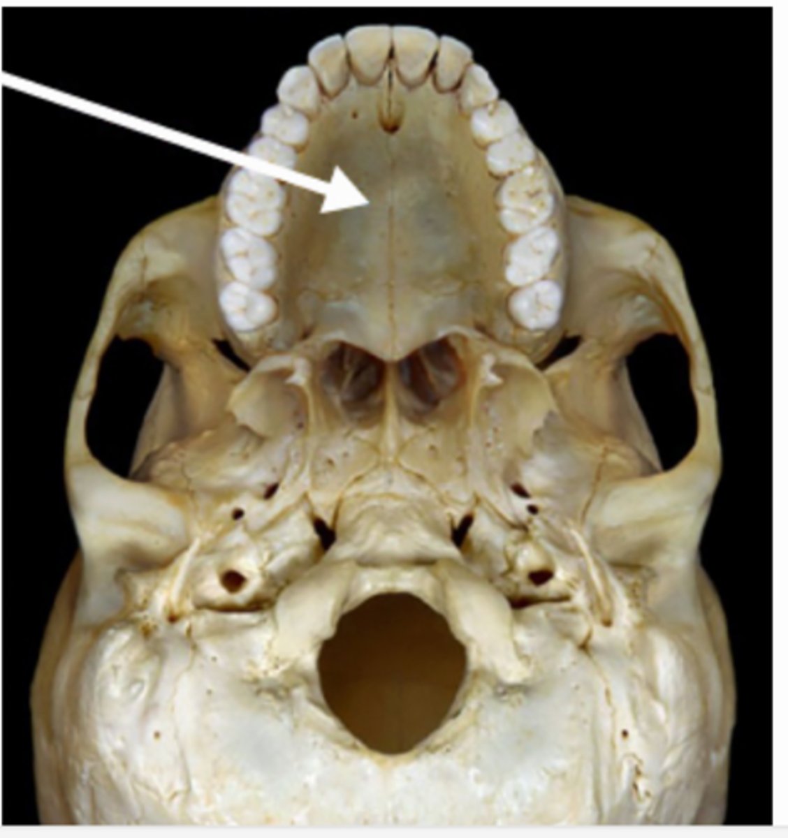 <p>anterior portion of the hard palate</p>