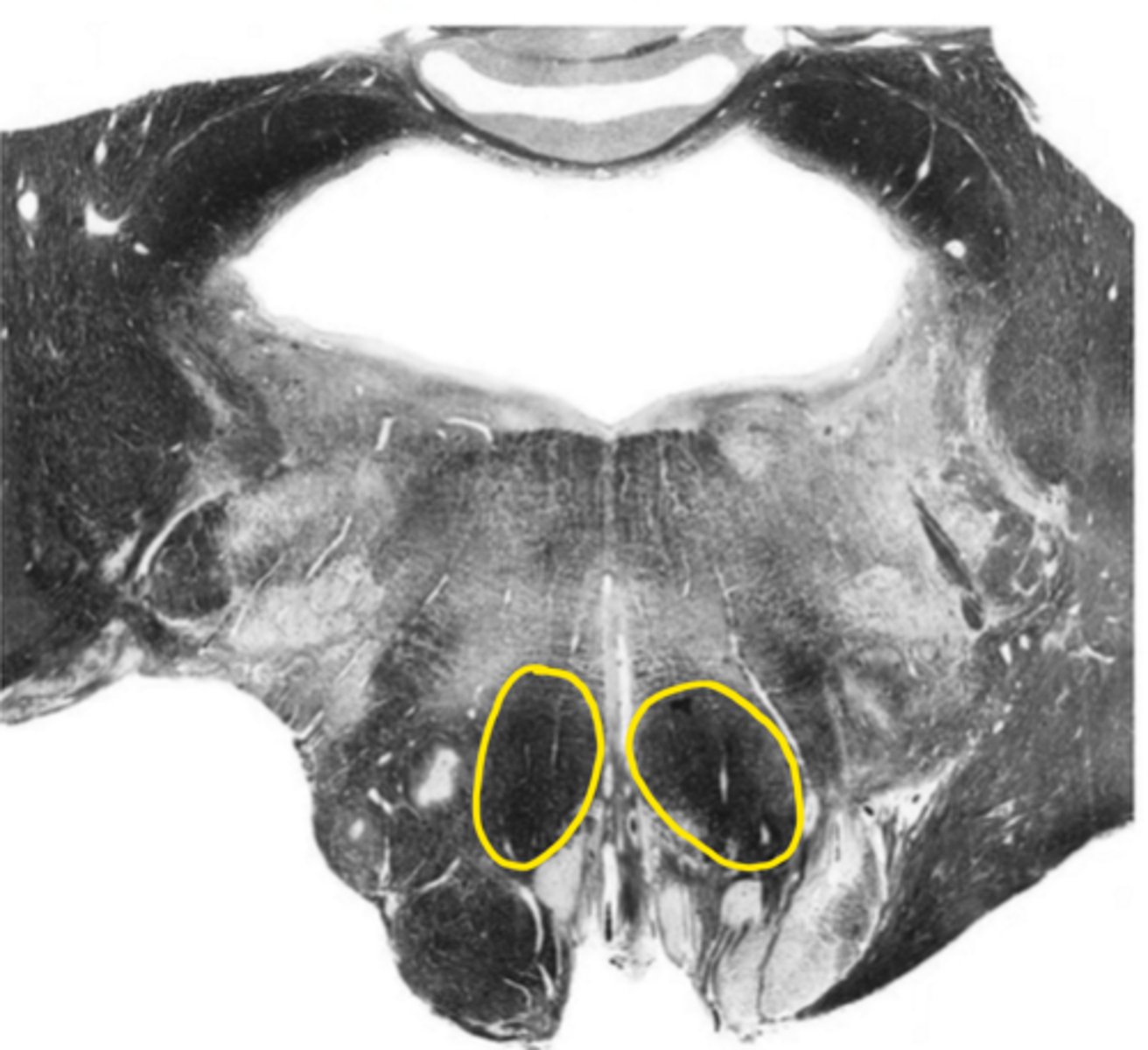 <p>ID the structure</p>
