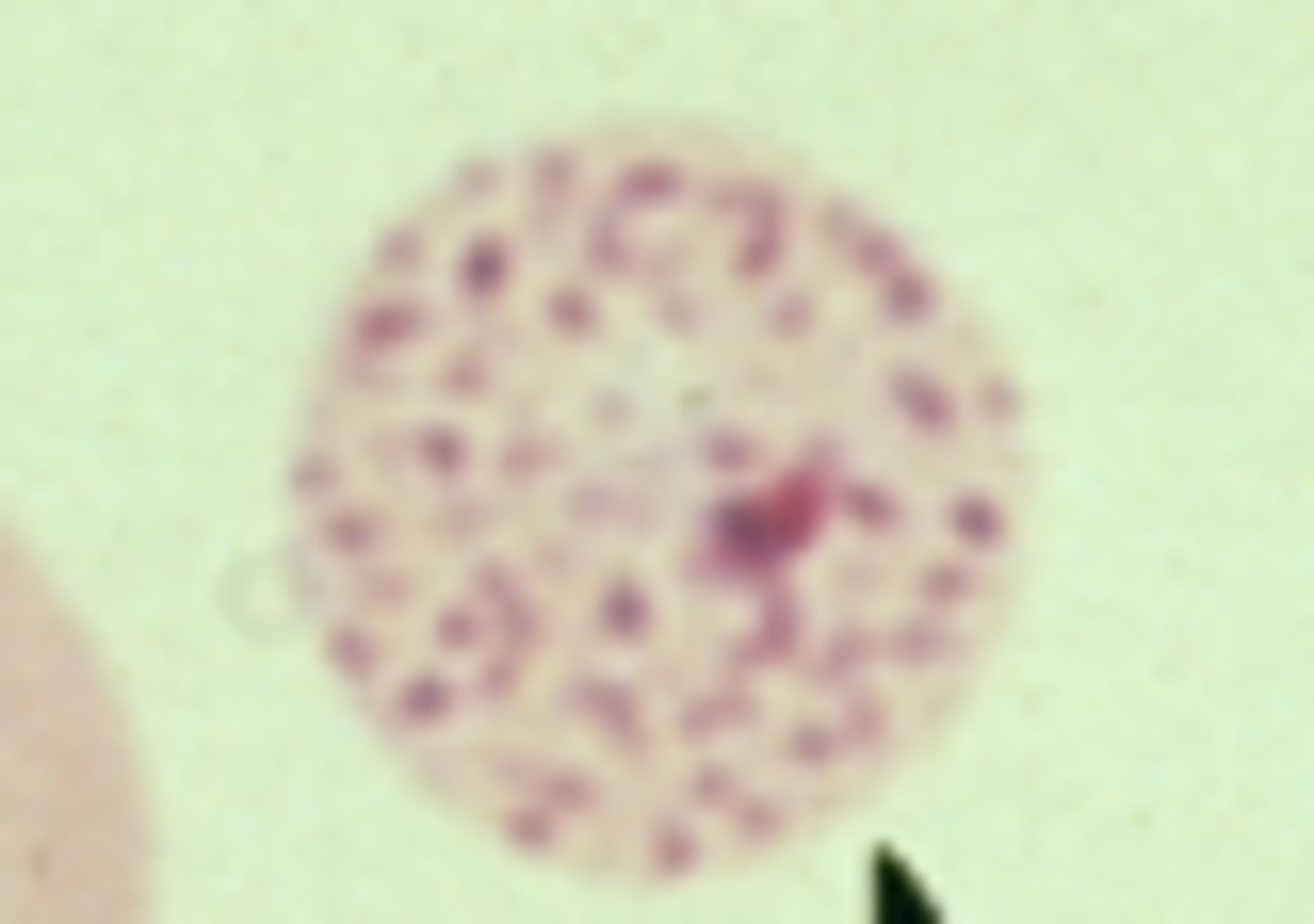 <p>What RBC morphology is this?</p>