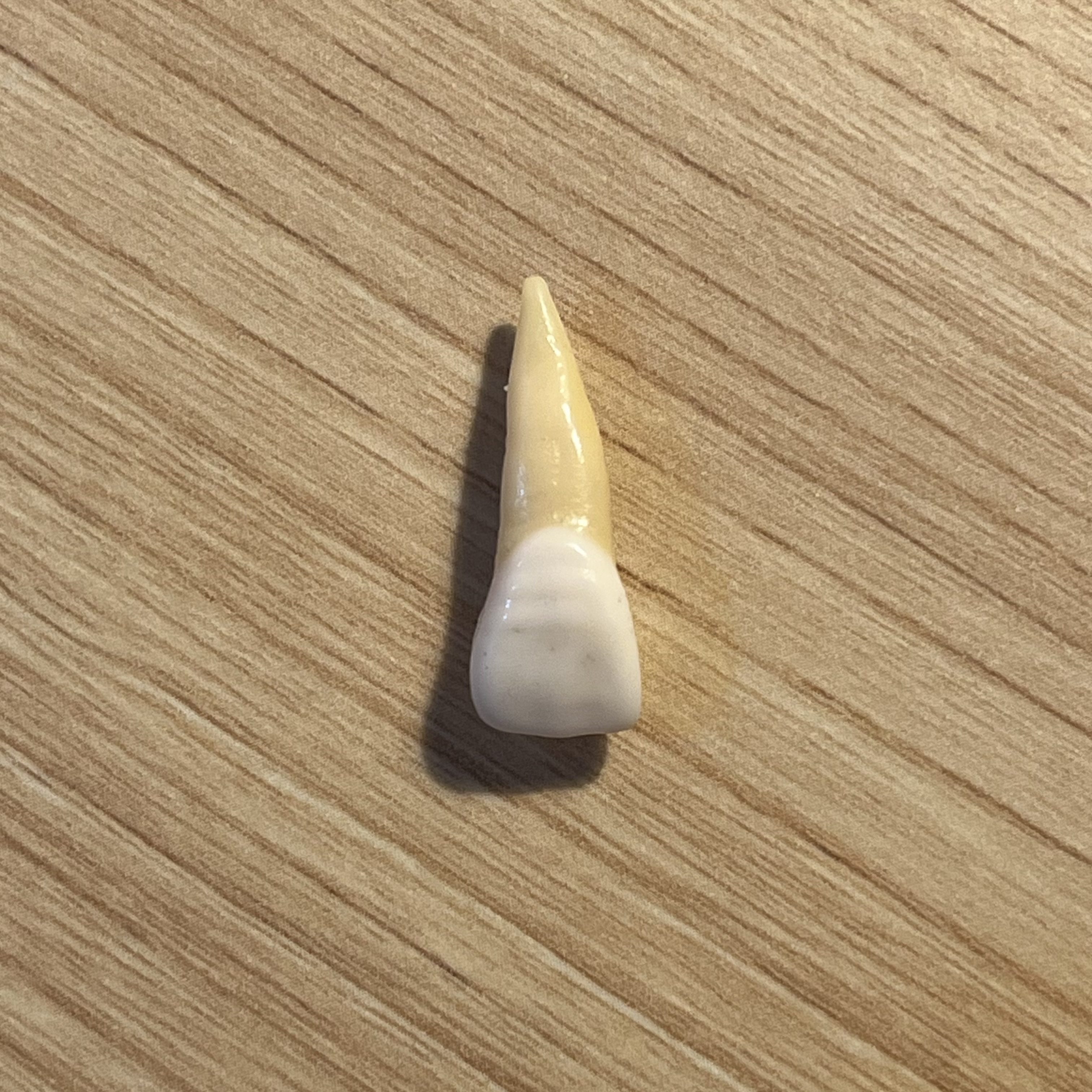 <p>What tooth is this (with view)?</p>