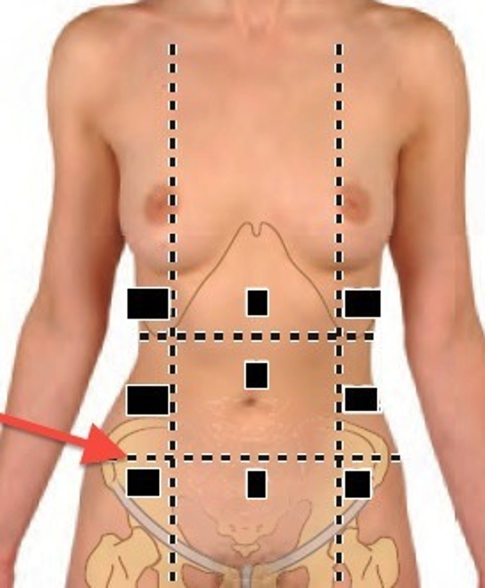 <p>The transtubercular plane is a horizontal plane through the tubercles of the iliac crests. It lies at the level of LV5.</p>