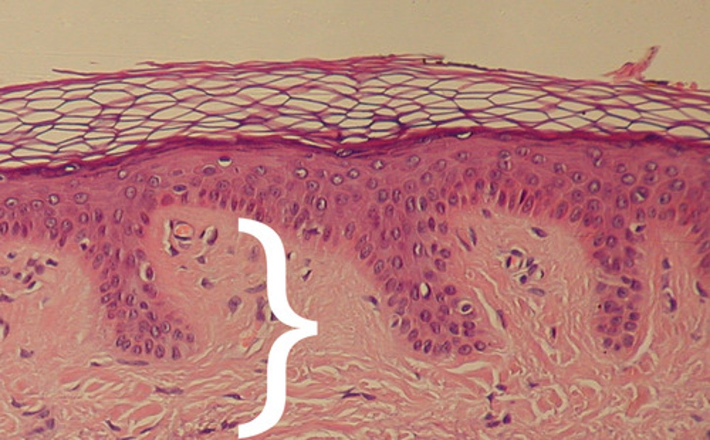 <p>Inner layer of skin</p>