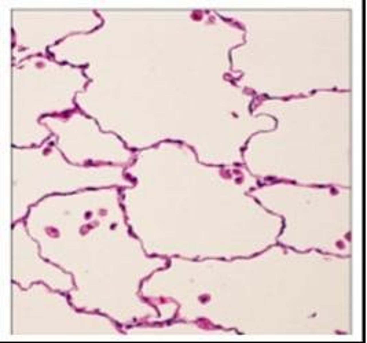 <p>single layer of flattened cells</p><p>- allows easy passage of materials by diffusion and filtration; secretes lubricating substances</p><p>- located in kidney glomeruli, air sacs of lungs, lining of heart and capillaries, and lymphatic vessels</p>