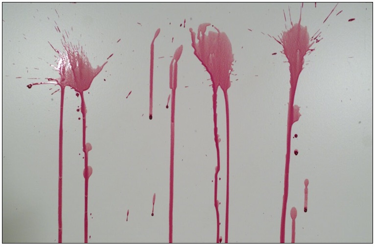 <p>blood released when a major artery is severed</p>