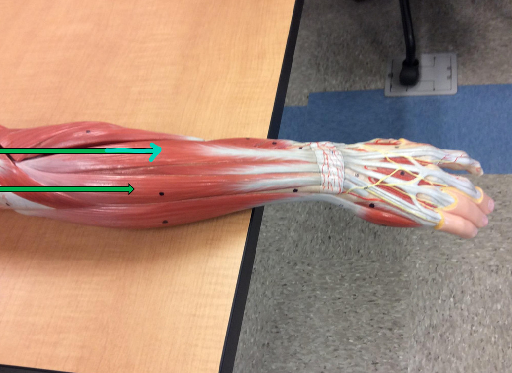 <p>Identify this muscle?</p>