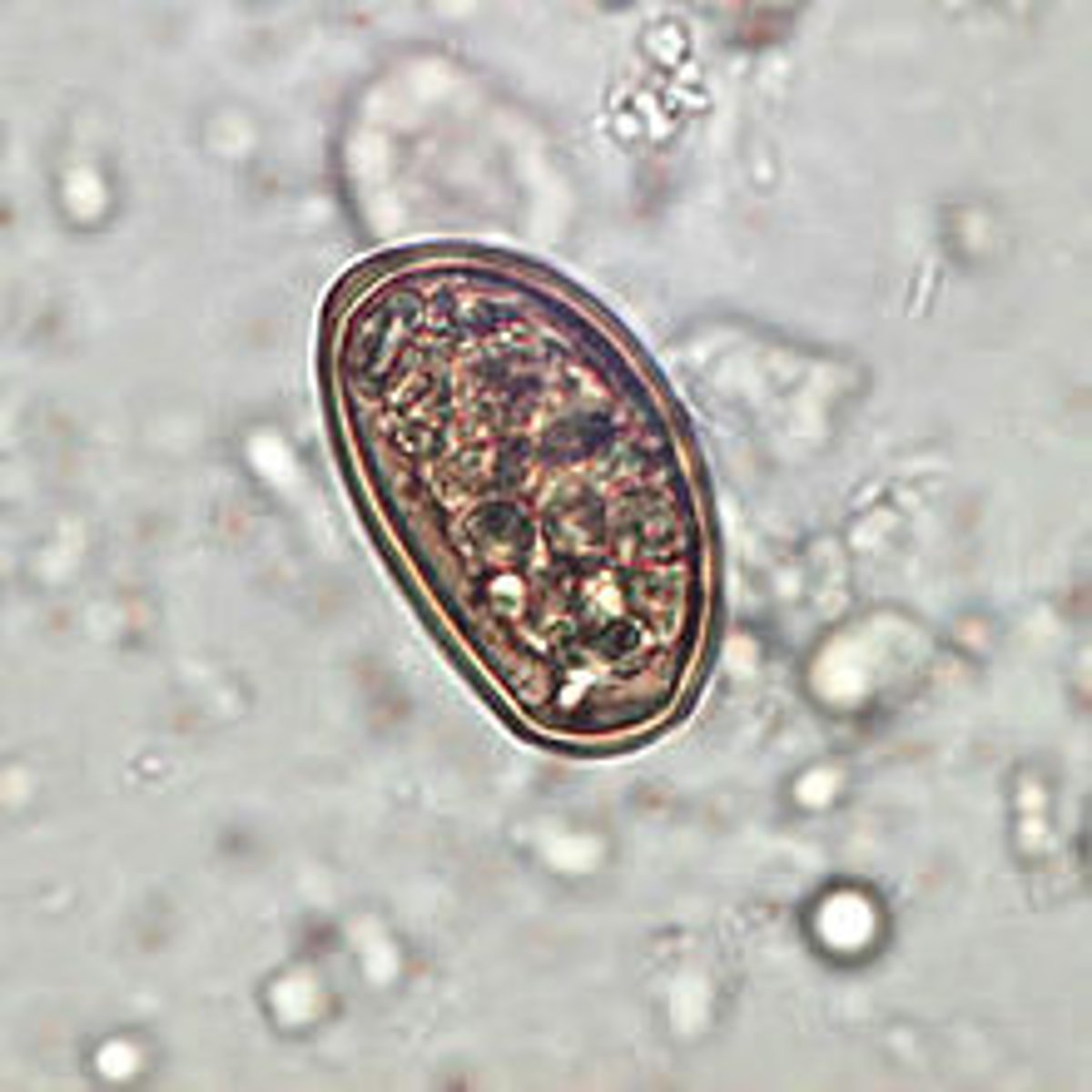 <p>Host: Sheep, Goats, & Cattle</p><p>1st I. Host = land snail, 2nd I. Host = ant</p>