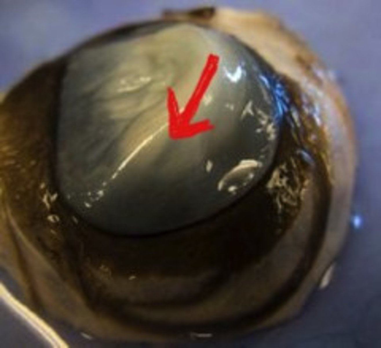 <p>transparent, watery fluid similar to plasma, but containing low protein concentrations. It is secreted from the ciliary epithelium, a structure supporting the lens</p>