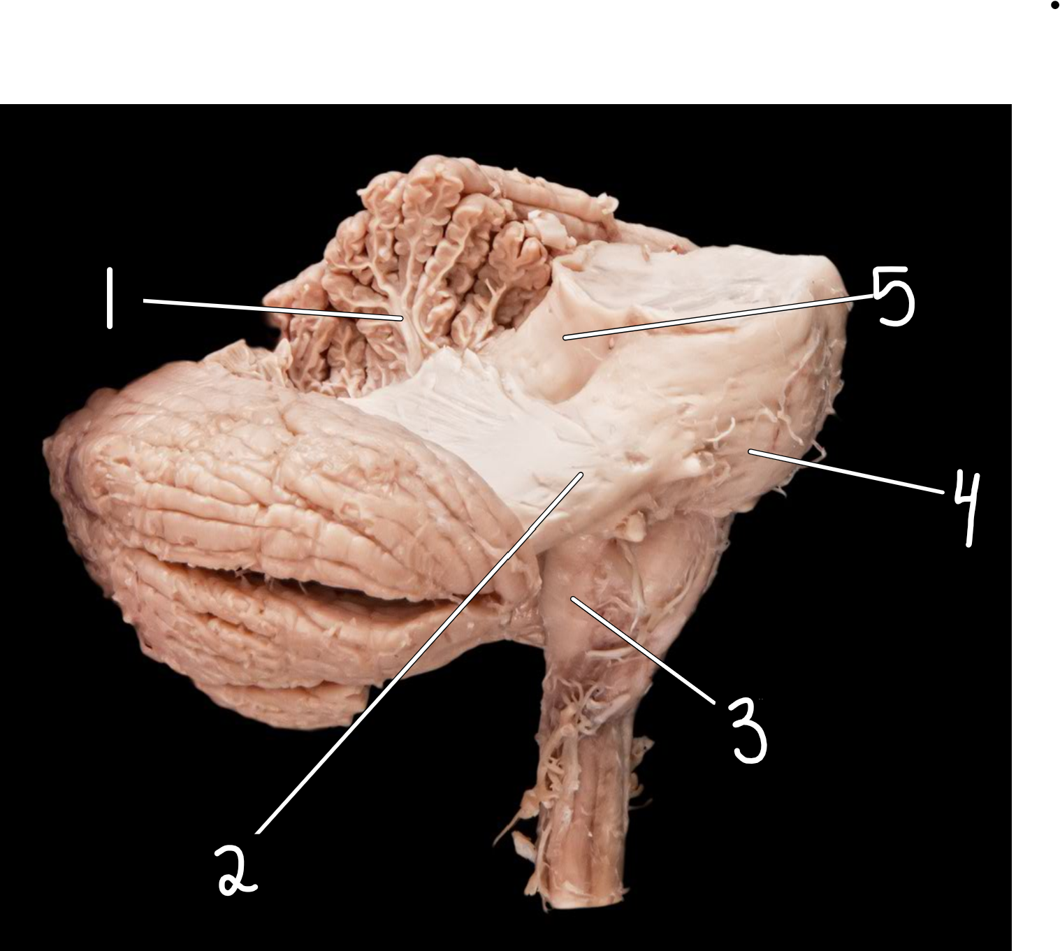 <p>Cerebellar peduncles: lateral view </p>