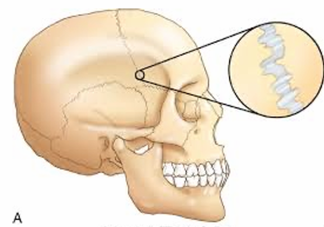 <ul><li><p>Often temporary</p></li><li><p>Little or no movement</p><ul><li><p>Skull</p></li></ul></li><li><p>Young animals </p></li></ul><p></p>