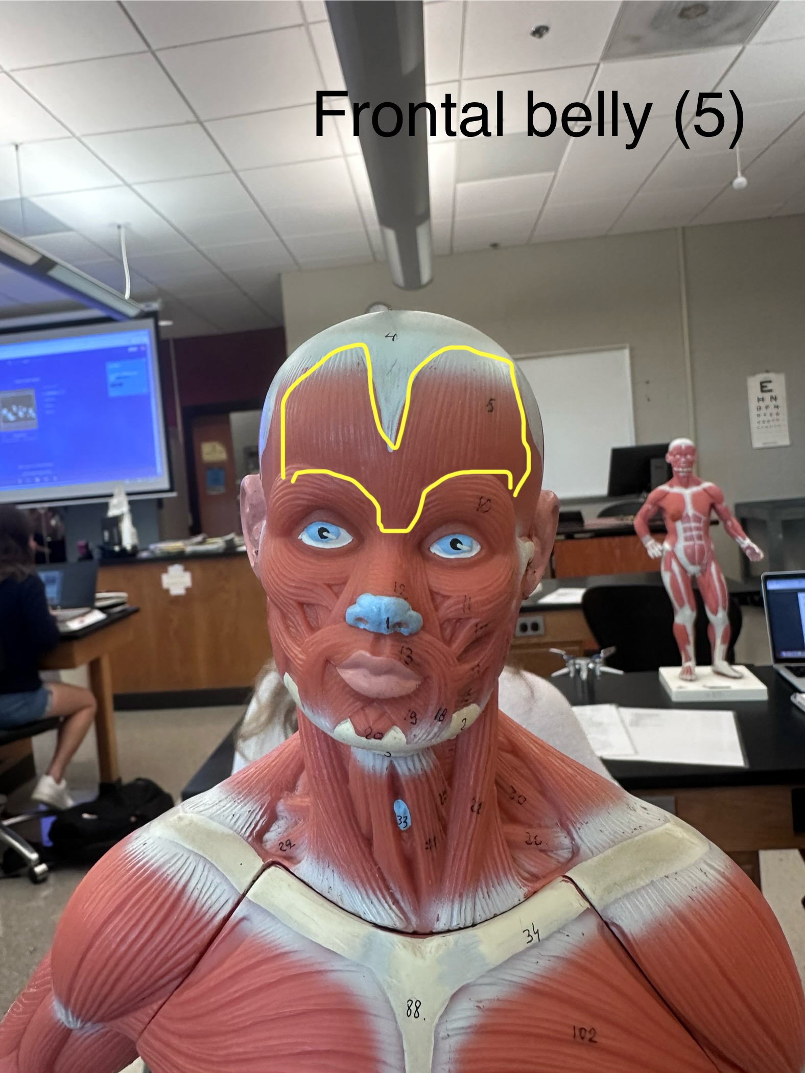 <p>Frontal belly muscle. This muscle raises the eyebrows (wrinkled forehead). </p>