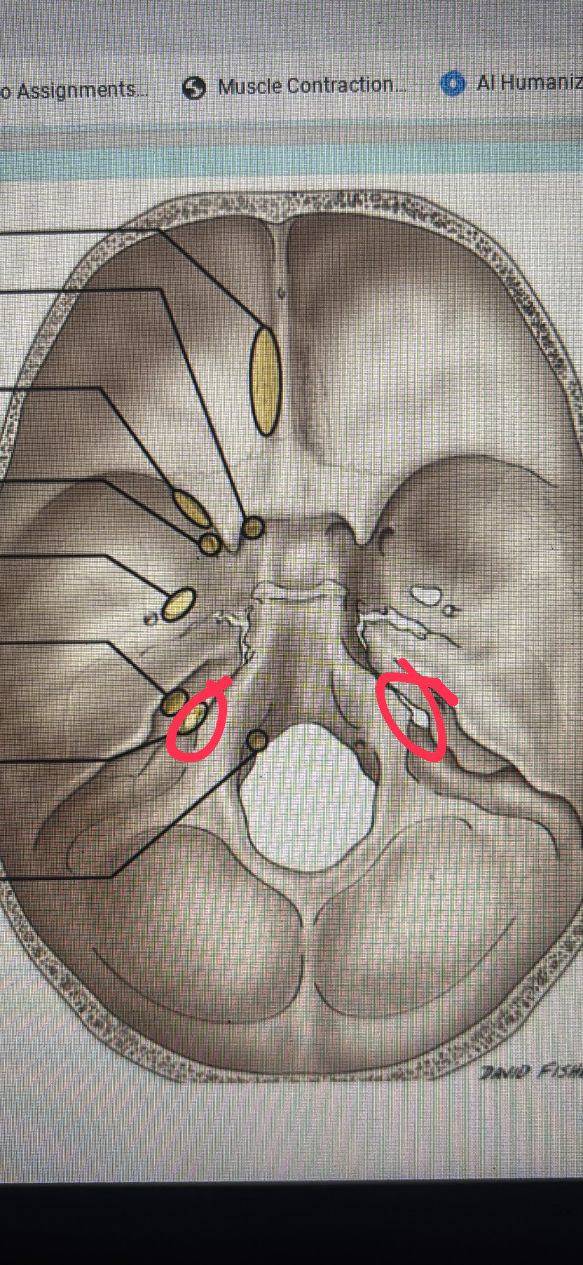 <p>cranial nerves IX, X, AND XI</p>