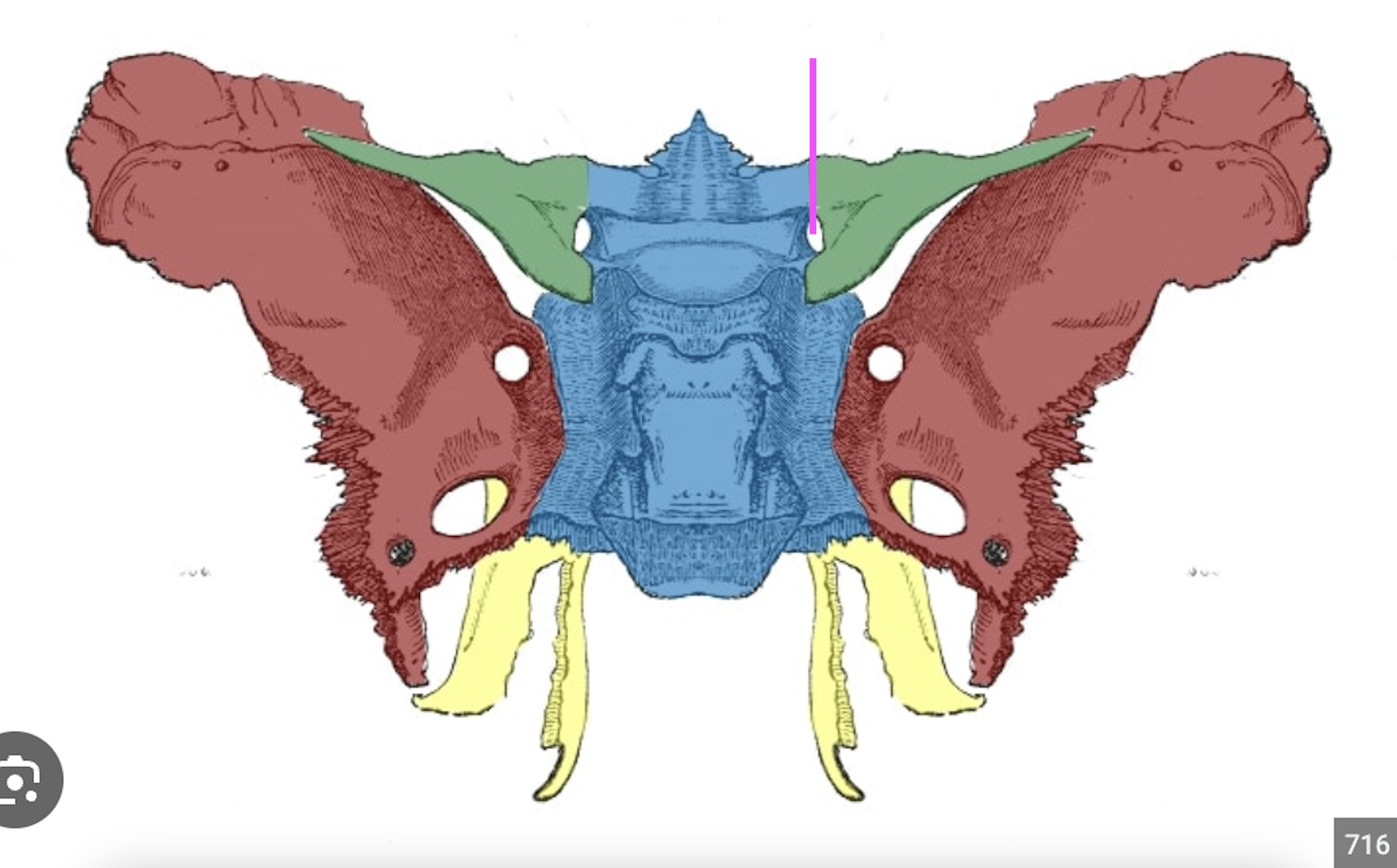 <p>What bone marking is this?</p>